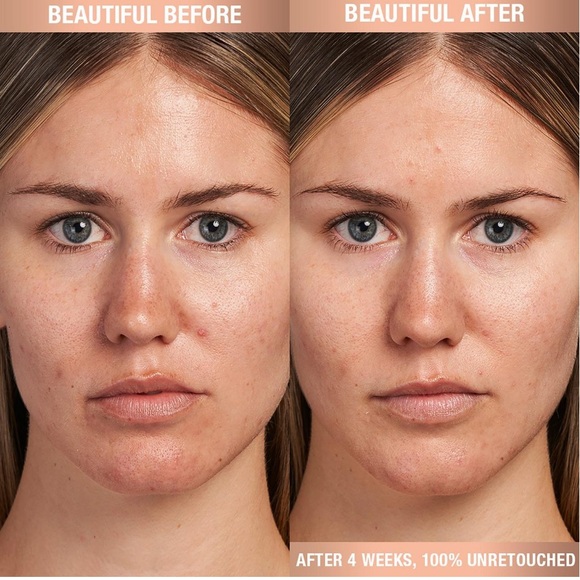 LAST 1! Charlotte Tilbury Magic Serum w/ Vitamin C 2PK 💧 NEW IN BOX - Picture 3 of 10